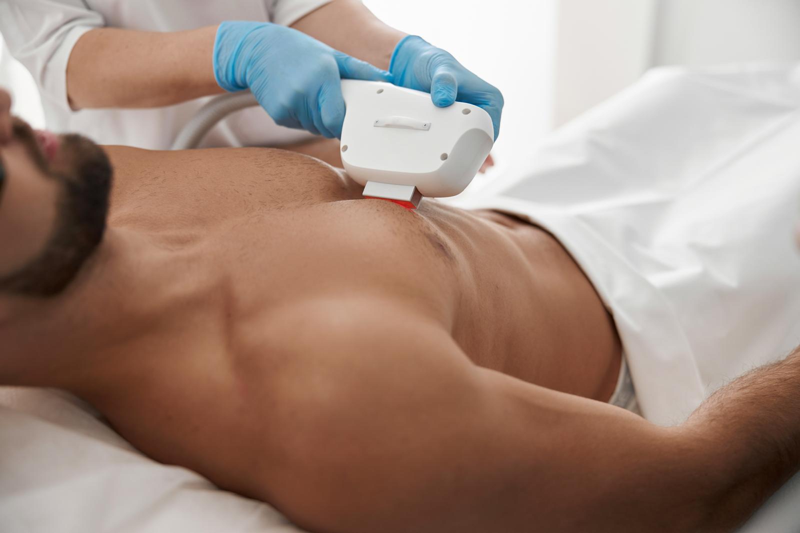 Laser Hair Removal vs Waxing