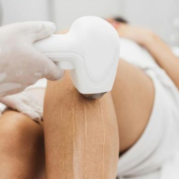 RF skin tightening in Melbourne