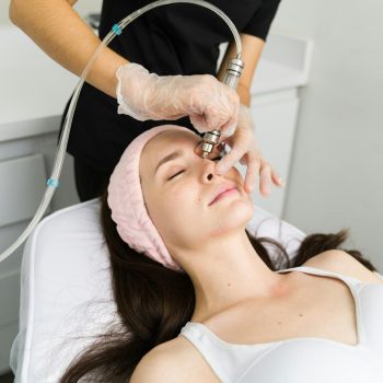 Carbon Facial Benefits
